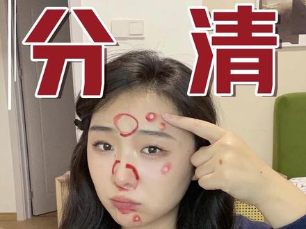 没有废话!豆豆快速分辨小妙招!告别长豆烦恼!#美妆 #护肤 #痘痘肌