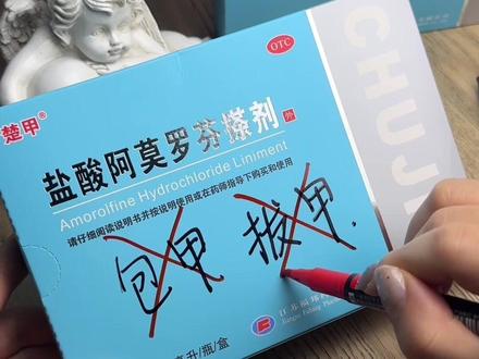 治灰指甲还在包甲?不需要!楚甲盐酸阿莫罗芬搽剂,国药准字正规OTC药品,用于治疗敏感真菌引起的指(趾)甲感染。自带工具,每周仅需使用1-2次。#健康#灰指甲 #灰指甲怎么办 #灰指甲用什么药 #阿莫罗芬