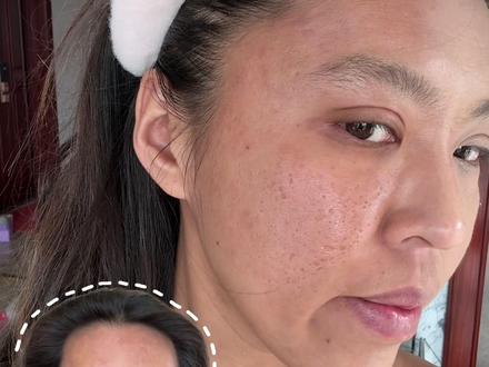 痘坑瑕疵皮底妆 快进来学 过年震惊所有人 想变美 一个字一个字的看哦#痘坑 #底妆 #遮瑕 #新手化妆教程