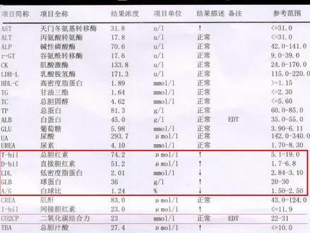 肝功能检查有异常,这些东西不要再吃!#健康 #养生 #医学科普 #肝功能