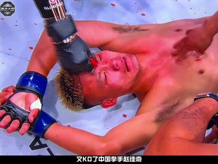 赵佳奇被阿曼塔耶夫KO#拳击 #赵佳奇 #赵洪刚 #格斗比赛