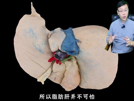 体检出现脂肪肝,哪里出问题?严重吗?需要怎么处理? #脂肪肝 #肝功能 #肝硬化 #抖出健康知识宝藏 #我的年度健康盘点