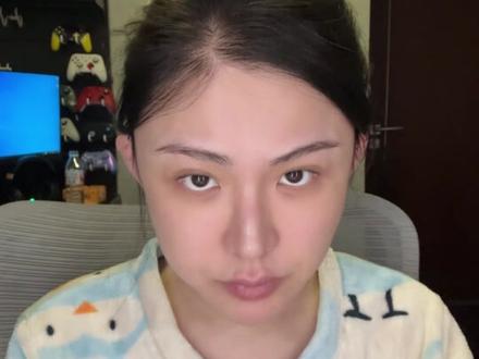 鼻子不好看的有福了!看台十年、do鼻六次的老y美人告诉你这10个do鼻信息差,一次上岸梦中情鼻,没有废话全是重点!#变美 #do脸 #直鼻微翘 #鼻综合 #真实生活分享官