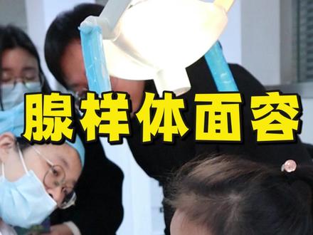 腺样体面容,遗传下巴后缩,戴头帽也没多大用! 腺样体面容+遗传下巴后缩
她这个下巴后缩不光是腺样体的问题,你遗传还占很大一部分,也是对我这个我了解如果是有遗传的,我们早期干预它的效果就是不太好。
像他这种脸型倒是可以戴头帽。但是有可能你戴一段时间的头帽,它后面还是会长成下巴小的这个样子。
戴头帽,下巴只能出来一点
如果你们呼吸能控制的好的话,嗯,他下巴还是会长出来一点,就算你什么都不带,他,下巴也是会出来一点。然后上面牙也会进去一点。
一个是把鼻炎和腺样体弄好。然后晚上睡觉的时候,把可以给他贴一贴呼吸贴,如果说想要好一点,可以戴一戴头帽。戴一年的时间,但是戴头帽的效果就是他也做不到跟正常人一样,他只能下巴稍微比现在出来一点。