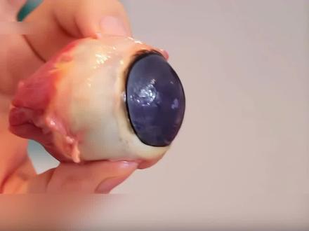 真实眼球解剖过程大揭秘 #医学科普 #科普 #眼科 #眼睛