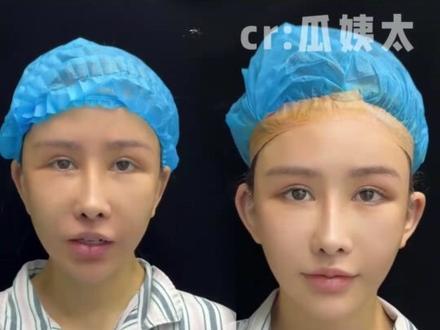 人怎么可以漂亮成这样#金美娜 #逆袭 #颜值