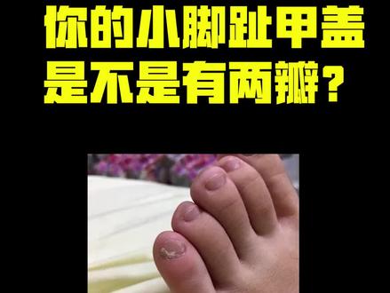 你的小脚指甲是不是有两瓣?为什么很多人会有这种现象? #科普知识 #涨知识 #脚指甲两瓣 #民间故事