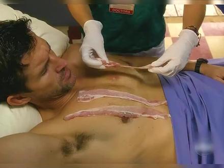 培根不仅好吃,治怪病也很好用