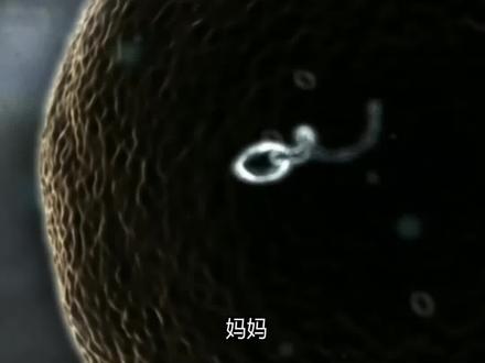 🎬 怀孕1-40周|胎宝宝发育全记录
怀孕的40周,就像一场生命的奇妙旅程。宝宝从一个小小的细胞,逐渐长成健康可爱的婴儿。
.
怀孕1-4周:受精卵完成着床,开始分裂成长,宝宝的心脏雏形已出现。
怀孕5-8周:宝宝心脏跳动,四肢萌芽,五官逐渐清晰,并在第8周正式升级为“胎儿”。
怀孕9-12周:宝宝能活动四肢,牙胚和指甲萌芽,胎盘接管营养供给,早期发育完成。
怀孕13-16周:胎动初现,眉毛头发发芽,骨骼逐渐硬化,耳朵能听见声音。
怀孕17-20周:宝宝学会吮吸手指,味蕾发育,翻身越来越灵活。
怀孕21-24周:小耳朵更灵敏,能分辨声音,肺部开始练习呼吸动作。
怀孕25-28周:宝宝能睁开眼睛,听觉敏锐,体重突破1公斤,开始打嗝。
怀孕29-32周:皮肤粉嫩光滑,懂得昼夜节律,动作更有节奏感。
怀孕33-36周:大脑高速发育,身体更圆润,宝宝多已转为头朝下姿势。
怀孕37-40周:足月宝宝准备就绪,胎动减少但更有力,随时等待和妈妈见面。
.
✨ 总结:
从1毫米的小点点,到足月约50厘米的宝宝,每一周的变化都是奇迹。40周的孕育,不仅是宝宝的成长,也是妈妈的蜕变。
#怀孕40周 #胎宝宝发育 #孕期记录 #孕妈日记 #胎宝宝