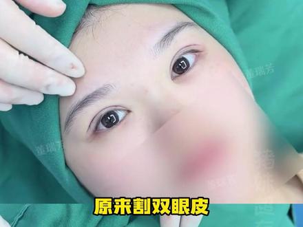 我眼皮凉凉的#双眼皮 #万万没想到 #双眼皮贴 #冷知识