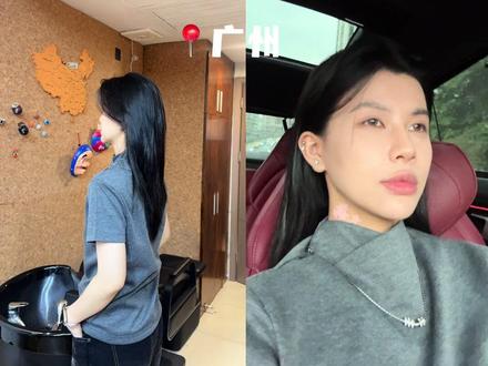 理发植发vlog ,最近在忙着恢复了#中性风 #鲻鱼头 #vlog #la