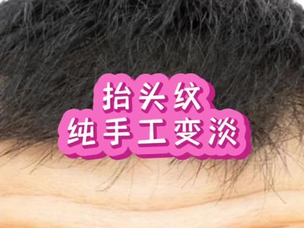 李哲教授教你纯手工变淡抬头纹