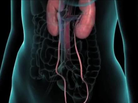 你了解血液透析是如何操作的吗#血液透析 #科普一下 #生命科学