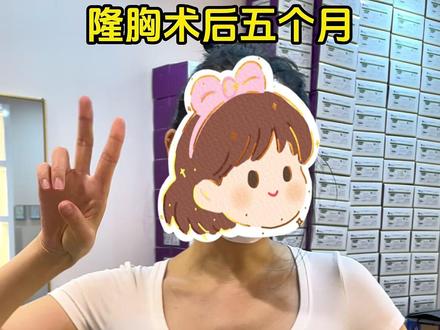 假体丰胸术后5个月。#隆胸术后真实感受 #隆胸分享 #隆胸真实案例