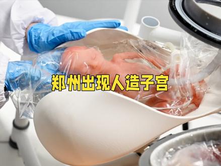 郑州竟然出现了人造子宫?还成功让胎羊在母体外存活了90分钟,这究竟是真是假?
2024年7月,郑州大学第一附属医院团队完成了全球首例“去ECMO化人造子宫动物实验”。这个团队可不简单,他们是由胸外科、妇产科等多科室的90后医生自发组成,而且还是自费研发的。实验中,他们巧妙地将胎羊的脐带血管与母体连接,替代了传统的ECMO设备来供氧,这一创新举措成功验证了体外孕育的可行性。#人造子宫 #郑州 #胎羊