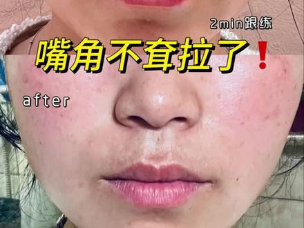 每天2min |改善嘴角耷拉 法令纹~面部瑜伽261天 #上热门 #面部瑜伽#口周肌肉#口轮匝肌#抗衰