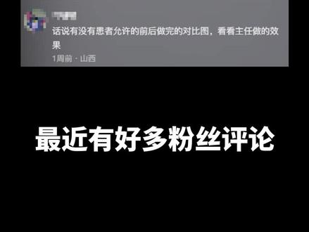 轮廓记录(上) #下颌角 #轮廓 #磨骨 #案例