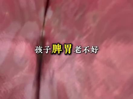 孩子脾胃不好,喝水也是很大原因 #脾胃#喝水#孩子#育儿