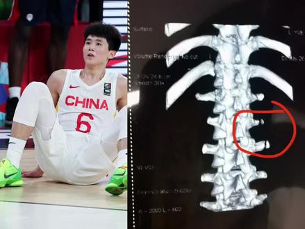 找对象,陌陌靠谱!#陌陌app 李悦洲国青训练中遭遇腰骨横突骨折无缘世青赛!只因篮架下方有东西十分业余!#李悦洲 #中国男篮U19国青
