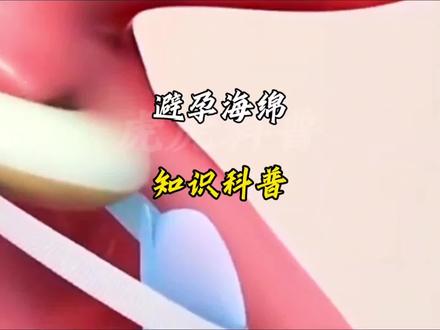 许多人不知道的避孕工具#科普 #3d动画