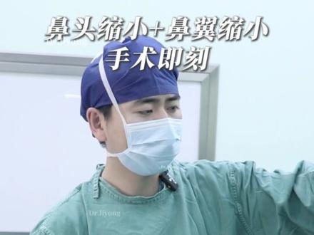 鼻头缩小+鼻翼缩小变化还是挺明显的~ #鼻翼缩小 #缩鼻翼 #整形医生李勇