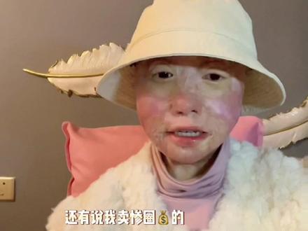 如果你不能给别人带来光,也请别熄灭了别人的光#四川乐山烧伤女孩乔燕 #抖音小助手