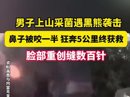 惊险!男子上山采菌遇黑熊袭击,鼻子被咬一半,狂奔5公里终获救!#黑熊 #男子 #采菌 #获救