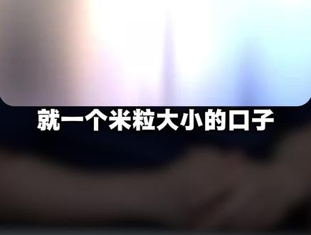 只要一个两毫米的小口子,就能永久的从根源骨相上解决你的鼻基底凹陷,塌鼻梁,下巴后缩,下颌角缺失等面部骨骼缺失问题,重塑你的面部骨性结构。#鼻基底凹陷 #下巴后缩 #下颌线收紧 #下颌角缺失 #自体骨再生