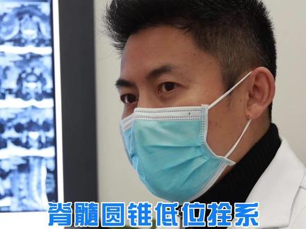 #脊髓拴系 #圆锥低位 出现这些症状就需要#手术 @抖音小助手