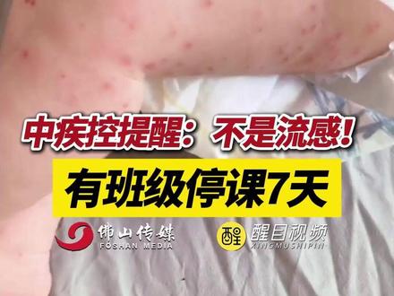 中疾控提醒:不是流感!有班级停课7天。(出镜:刘畅;编辑:黄雅琳;责编:崔锦玥;素材来源:国家应急广播)#手足口病 #注意 #家长必读 #科普 #提醒 流感来袭