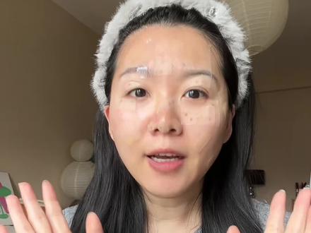 切痣,点痣,祛斑!在哪里做?要花多少钱?后期怎么护理?保姆级教程一步到位!
#记录真实生活 #创作者中心 #创作灵感 #切痣 #点痣