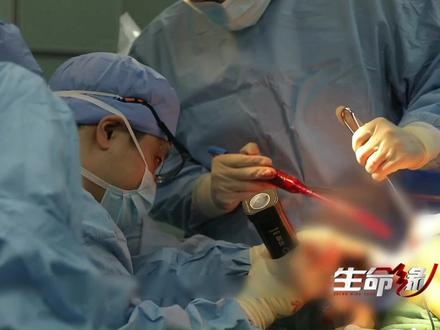 折叠人的涅槃重生之路,经历四次拆骨重装之痛!他终于成功挺直了腰板!#感动#医者仁心 #人间有爱 #北京卫视生命缘#纪录片解说