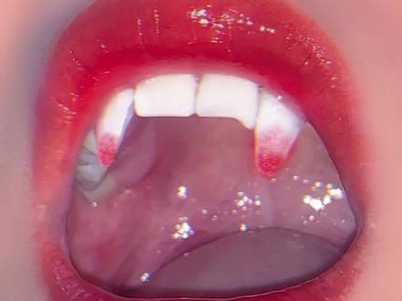 教你轻松拍出有虎牙照片,快和你的姐妹学起来拍一个 #醒图 #教程