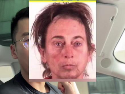 女生使用类固醇的副作用!#健身#撸铁女孩