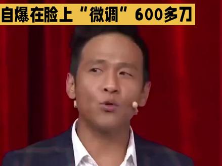 宋小宝自爆在脸上“微调”600多刀,现场无人信,这究竟是怎么回事呢?
在《王牌对王牌》9的节目中,宋小宝语出惊人,自曝自己曾经接受过“微调”,而且还是在脸上动了600多刀。这话一出,现场瞬间炸开了锅,彭昱畅更是直接提问:“宝哥,你微调,是怎么调的?”把沈腾都逗乐了,沈腾调侃道:“你是不是想问微调的意义在哪儿?”大家都笑成一团,显然没人相信宋小宝的话,毕竟他看起来和之前真的没什么差别。然而,当结果公布时,大家都惊呆了,原来宋小宝说的居然是真的!他所谓的动过600多刀,其实是为了不用画眉毛,直接去纹了个眉。这么一看,宝哥的纹眉技术真的很自然,完全没有人发现他的眉毛是纹的,不愧是老牌艺人,连“微调”都能这么大大方方地说出来。
宋小宝的这次“微调”经历,真是让人捧腹大笑,也让我们看到了他真实、不做作的一面。大家对于宋小宝的“微调”有什么看法呢?快来评论区留言讨论吧!#宋小宝 #沈腾