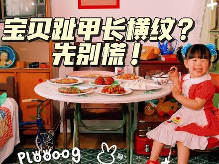 3岁宝宝脚趾甲长横纹?别再乱猜了👇
赶紧带娃咨询了正规医院的医生🧑⚕️,才知道宝宝这种横纹,叫甲横嵴(也叫博氏线),90%的儿童出现这个情况,都是良性的,放轻松!
把医生给我的个人建议分享给同款慌神的宝妈,大家可以参考:
✅ 良性情况,大多是这几个原因:
① 近2-3个月宝宝有过发烧、感冒等感染情况
② 鞋子不合脚挤压、宝宝抠抓脚趾导致的局部刺激
③ 挑食偏食,营养摄入不均衡
✅ 医生给的居家护理建议:
① 有明确生病史的,不用特殊处理,定期修剪趾甲,等它自然代谢就好
② 给宝宝换鞋头宽松、软底透气的鞋子,剪趾甲别剪太短,避免伤到甲床
③ 调整饮食,保证营养均衡,纠正挑食偏食的习惯
❌ 如果出现趾甲持续增厚变色、多个指甲都出现横纹加重、伴随宝宝不适、皮肤红肿瘙痒的情况,一定要第一时间带娃去正规医院就诊,别自己瞎判断!
⚠️ 仅为我个人带娃的亲历经历和医生给我的个人建议分享,不构成任何医疗指导,宝宝身体有任何不适,请一定及时线下就医🫶🏻
✅ 宝妈建议收藏!下次遇到直接对照不慌神
✅ 持续解锁更多宝宝护理干货
你们家宝宝有没有过同款趾甲长横纹的情况?评论区一起聊聊呀🤗
#宝妈育儿分享 #育儿干货 #宝妈避坑 #新手妈妈 #宝宝脚趾甲
