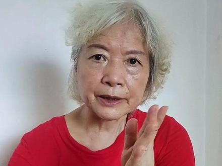 乳腺术后22年,我为什么坚持佩戴义乳?#乳腺 #关爱女性健康 #健康