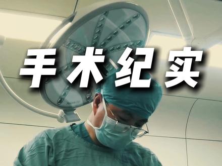 完整吸脂手术实录 #填充 #脂肪