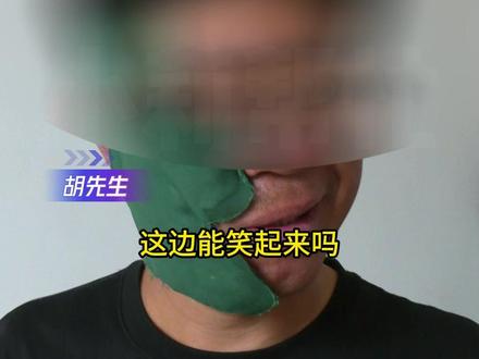 男子因头晕体验针灸理疗(1),一周后半边脸不受控制,“正头顶那根针他们忘取了!“店方:可能忘了,没有副作用。#河南dou知道