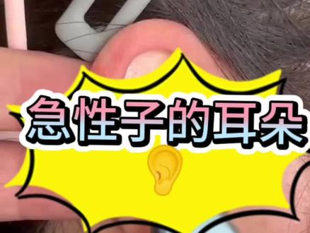 #耳穴 耳朵知道答案---你是急性子吗?看看这里就知道!#中医 #中医养生 #神奇的耳朵 #着急