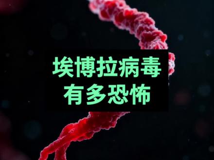 非洲埃博拉病毒有多恐怖? #埃博拉 #埃博拉病毒 #非洲埃博拉病毒 #科普知识