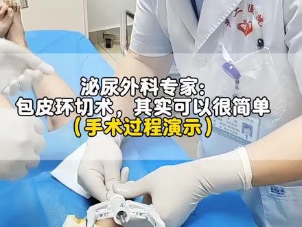 #包皮环切吻合术 #包皮健康