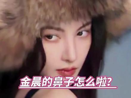 金晨的鼻子到底咋啦? #金晨