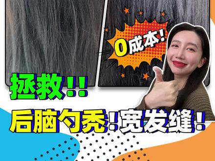 听说你后脑勺秃了?发缝也宽?看完这个视频!好办!#秃头少女 #发型 #发量王者 #变美 #增加发量