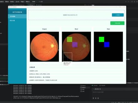 (六)使用 AI 设计界面,完成自己 UNet 医学分割系统