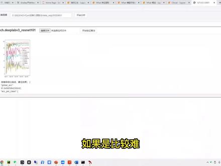通过影像组学工具如何快速实现乳腺癌腋窝淋巴勾画和标注#影像组学 #医学影像