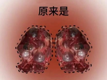 反复长痘的家人一定要看!#痘痘#痘痘逆袭#油痘肌#抗痘#内调外养好气色