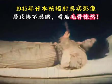 1945年日本核辐射真实影像,居民惨不忍睹,看后毛骨悚然! #历史 #老视频 #珍贵影像 #日本核辐射