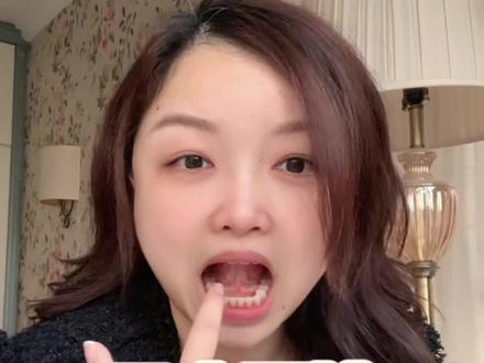 口齿不清怎么改善 #就想说点大实话 #大舌头#口齿不清