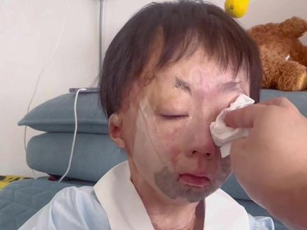 这些年经历了什么,大概只有自己知道吧、这几年的折腾、早已让我变的面目全非,从直来直去变得小心翼翼,刚开始只是假装坚强 ,后来…真的坚强了 很庆幸一路都撑过来了,如今你一句想上学了,却让我再次不知所措……#但愿你的眼睛只看得到笑容 #河南信阳烧伤女孩小依娜